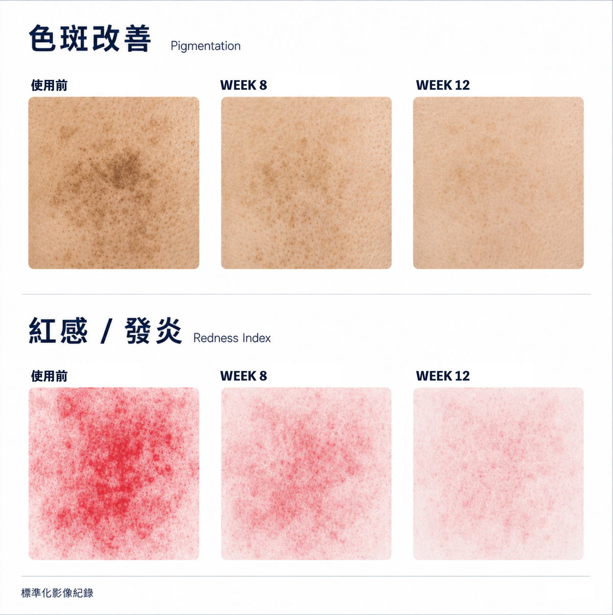 看得見的改善